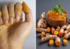 The Golden Turmeric Touch: A Simple Solution for Stained Hands