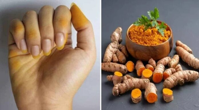 The Golden Turmeric Touch: A Simple Solution for Stained Hands