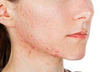 The 7 Warning Signs of Hormonal Imbalance in Women