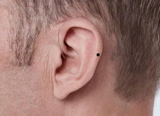 The Man with a Mole in This Position is Filthy Rich