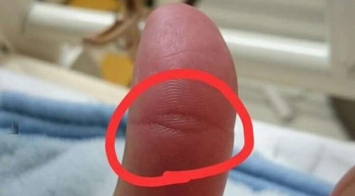 The Enlightened One’s Mark: Those With This Thumb Print Are Destined For A Life Of Fortune And Ease.