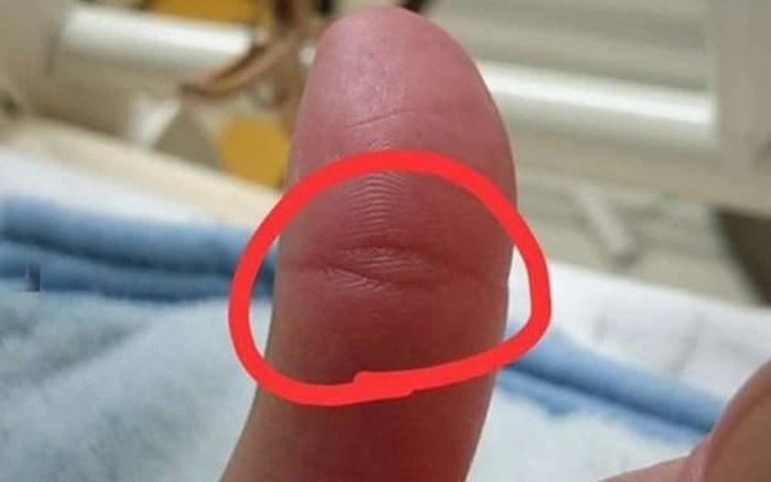 The Enlightened One’s Mark: Those With This Thumb Print Are Destined For A Life Of Fortune And Ease.