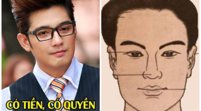 The Wealthy Man’s General: Aging with Affluence