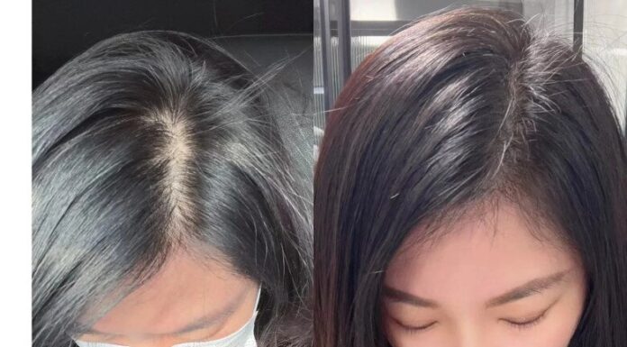 The Ultimate Guide for Women Over 40: 5 Simple Steps to Reverse Thinning Hair and Boost Your Confidence