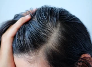 The Ultimate Guide to Greasy Hair: 3 Tips to Transform Oily Locks Without Dry Shampoo