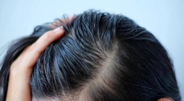 The Ultimate Guide to Greasy Hair: 3 Tips to Transform Oily Locks Without Dry Shampoo