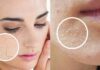 7 Essential Tips to Rescue Dry, Flaky Skin