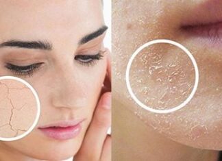 7 Essential Tips to Rescue Dry, Flaky Skin
