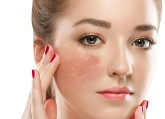 10 Skin-Brightening Tips to Transform Your Dull, Dark Complexion