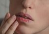 What Causes Dry Lips and How Can You Effectively Treat Them?