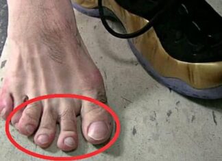 The Ancestors’ Warning: ‘The Second Toe Longer Than the Big One, You’ll Grow Up Disobedient’ – Myth or Reality?