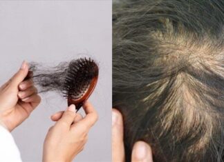 The Two Foods That Are Causing Your Hair to Fall Out: A Warning for Those Wanting to Keep a Full Head of Hair.