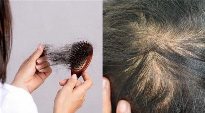 The Two Foods That Are Causing Your Hair to Fall Out: A Warning for Those Wanting to Keep a Full Head of Hair.