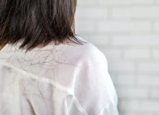 The 3 Foods That Fuel Hair Loss in Women: Are You Eating Your Way to Thinning Locks?