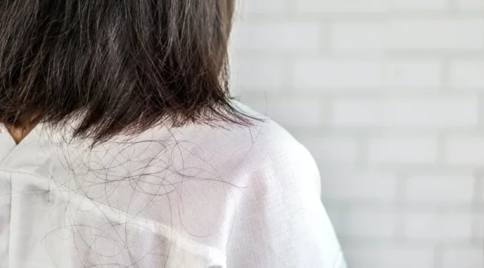 The 3 Foods That Fuel Hair Loss in Women: Are You Eating Your Way to Thinning Locks?