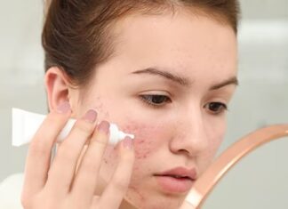 The Ultimate 6-Step Recipe for Clear Skin: Unveiling the Power Nutrients for a Flawless Complexion