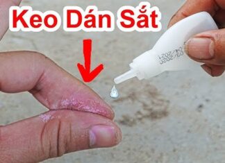 “Super Glue Mishap: An Easy Fix That Won’t Tear Your Skin”