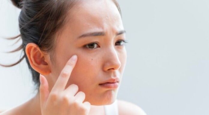 4 Bad Habits That Are Ruining Your Skin