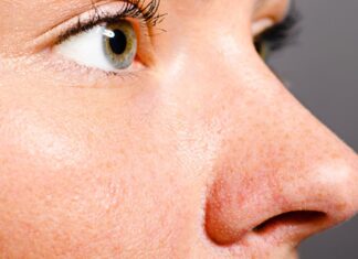 6 “Life-Saving” Tips to Minimize Large Pores and Achieve a Flawless, Healthy Complexion