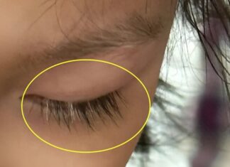 “A Mother’s Regret: The Little Girl with White Eyelashes”