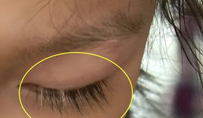 “A Mother’s Regret: The Little Girl with White Eyelashes”