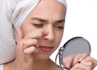 5 Natural Home Remedies to Get Rid of Blackheads
