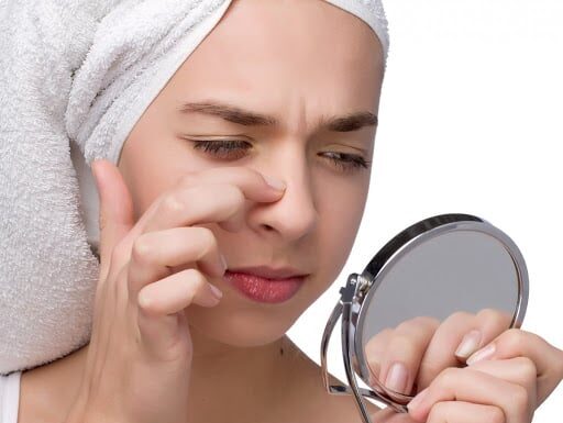5 Natural Home Remedies to Get Rid of Blackheads