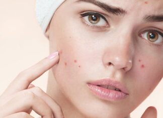 8 Reasons Why You’re Breaking Out