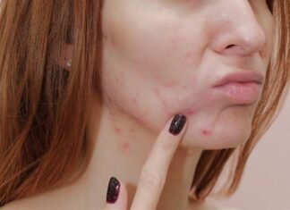 The Dangers of Using Expired Cosmetics: 5 Ways It Can Damage Your Skin