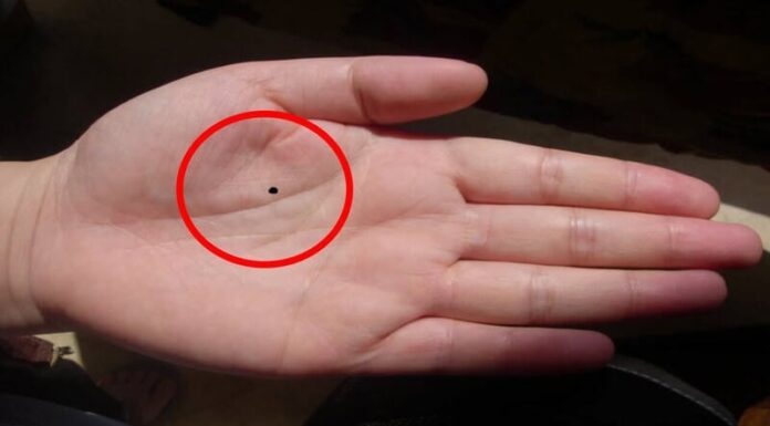 The Man with a Mole in This Spot is Filthy Rich