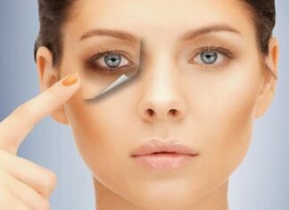 6 Ways to Banish Dark Circles and Brighten Your Tired-Looking Face
