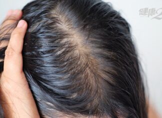 The Ultimate Guide to Hair Loss: 8 Superfoods for Thicker, Fuller Hair That Rivals Any Post-Spa Look