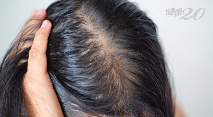 The Ultimate Guide to Hair Loss: 8 Superfoods for Thicker, Fuller Hair That Rivals Any Post-Spa Look