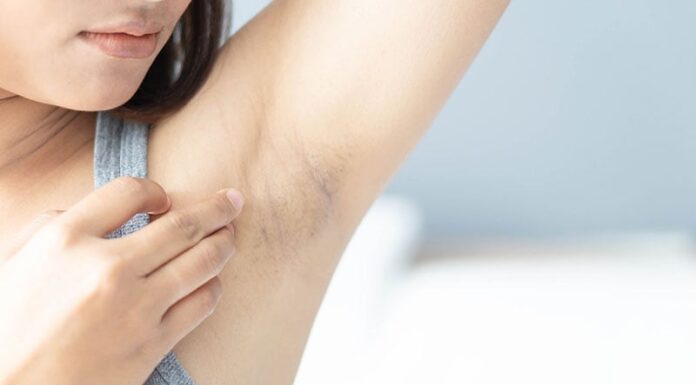The Ultimate Guide: 7 Simple Tips to Brighten and Smoothen Your Underarms