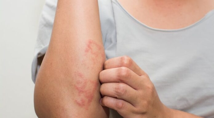 The Silent Symptoms of Blood Cancer: What You Need to Know