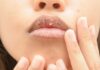 The Ultimate Hack to Rescue Chapped Lips Post-Lip Gloss Application