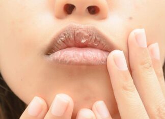 The Ultimate Hack to Rescue Chapped Lips Post-Gloss Application