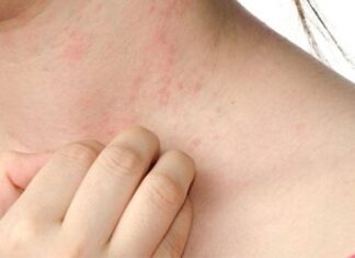 The 5 Warning Signs of Advanced Liver Disease: Be Alert and Get Checked