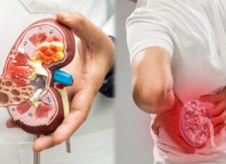 5 Warning Signs Your Kidneys Are in Danger – Time to See a Doctor