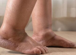 “3 Foot Symptoms That Could Be Warning Signs of Lung Cancer”