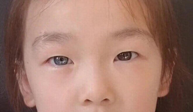 The Little Girl with the “Strange” Eyes: A Tale of Unexpected Fame and Emotional Family Moments.