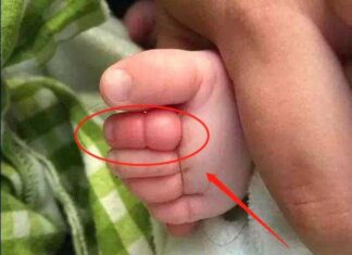 A Father’s Swim Session With His 2-Year-Old Takes a Shocking Turn: A Tale of a Swollen, Red Toe