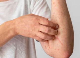 8 Warning Signs You May Have Advanced Kidney Disease: When to See a Doctor ASAP