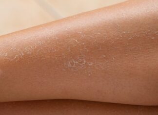 The Ultimate Guide to Choosing the Perfect Bathing Milk for Your Dry, Parched Skin