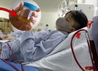 2 Warning Signs of Kidney Damage: When Your Morning Urine Looks Like This, It’s Time to See a Doctor