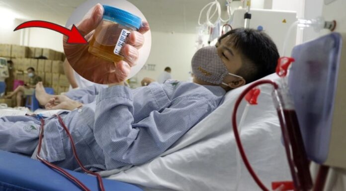 2 Warning Signs of Kidney Damage: When Your Morning Urine Looks Like This, It’s Time to See a Doctor