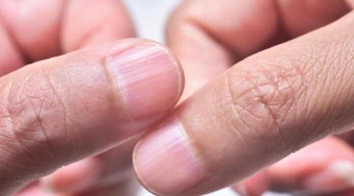 The Ultimate Guide to Kidney Health: 3 Tell-Tale Signs for Men to Identify a Healthy Kidney