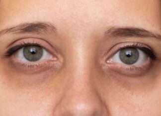 3 Body Spots That Turn Black, Warning of Weak Kidneys