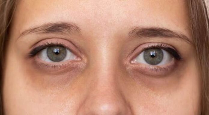 3 Body Spots That Turn Black, Warning of Weak Kidneys