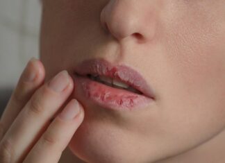 5 Harmful Habits that Dry Out Your Lips and 5 Tips to Get that Luscious Pout Back